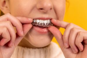 A clear dental aligner is being held