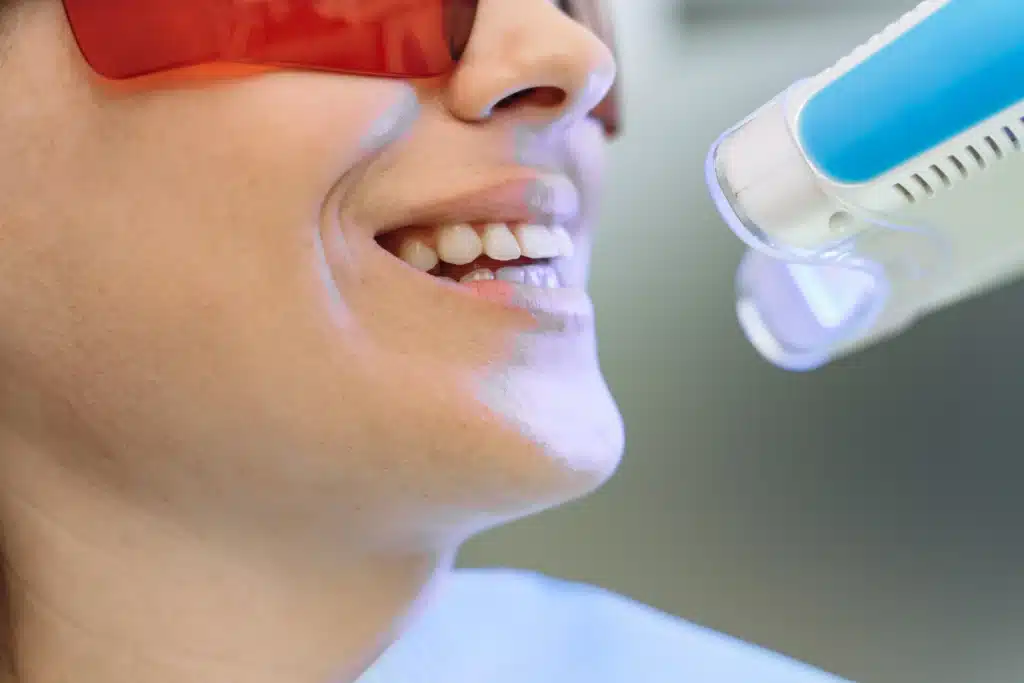 woman in a dental chair for teeth whitening process