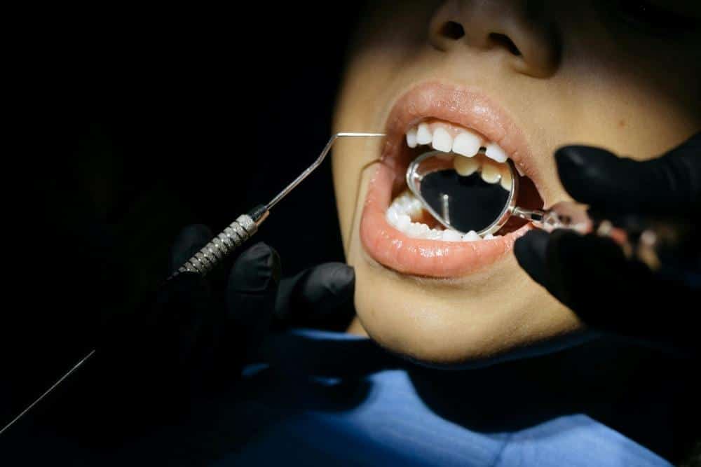 Alt text: A child’s baby teeth being examined by the dentist